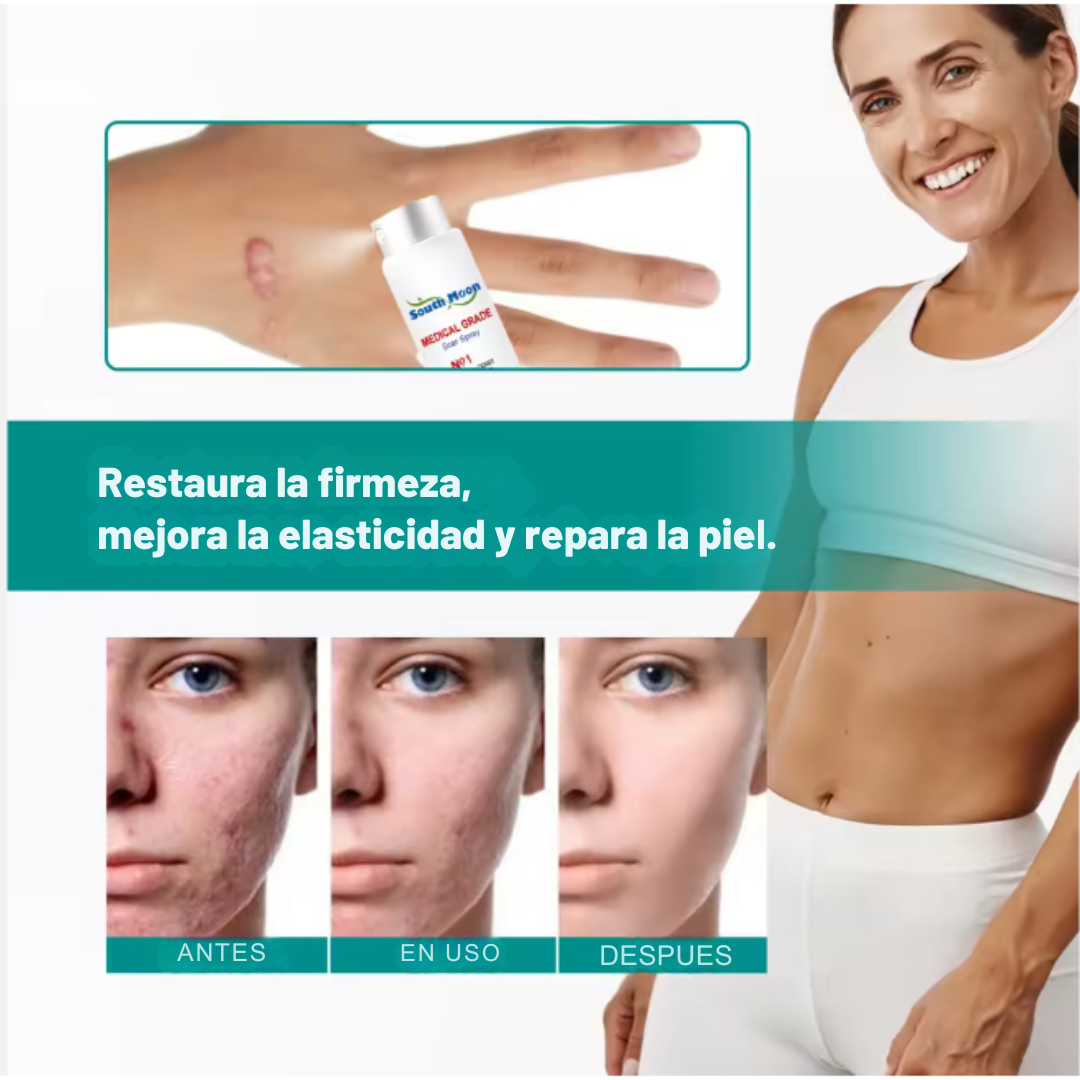 SouthMoon Spray™ Anticicatrices - La Cicatriz Cuenta Tu Historia, Pero Tú Decides Cómo Se Ve
