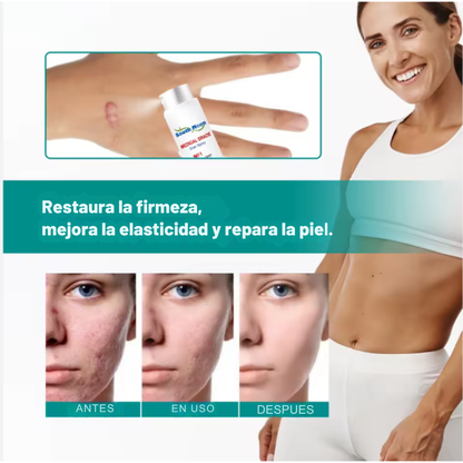 SouthMoon Spray™ Anticicatrices - La Cicatriz Cuenta Tu Historia, Pero Tú Decides Cómo Se Ve