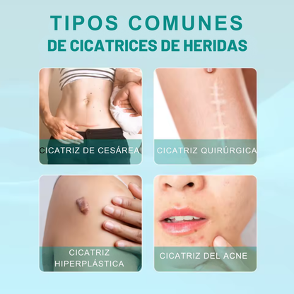 SouthMoon Spray™ Anticicatrices - La Cicatriz Cuenta Tu Historia, Pero Tú Decides Cómo Se Ve