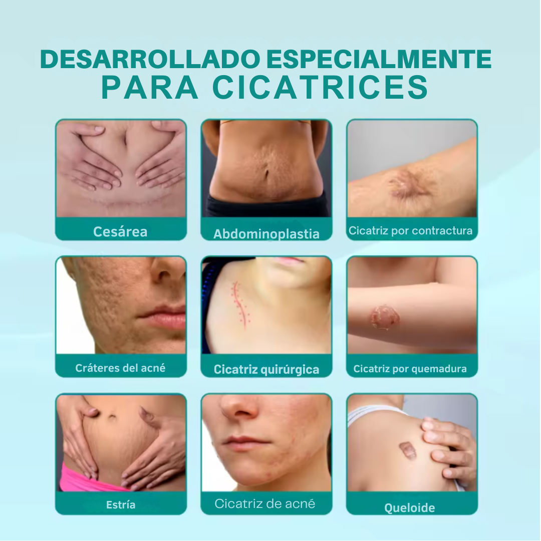 SouthMoon Spray™ Anticicatrices - La Cicatriz Cuenta Tu Historia, Pero Tú Decides Cómo Se Ve