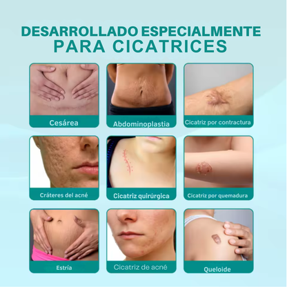 SouthMoon Spray™ Anticicatrices - La Cicatriz Cuenta Tu Historia, Pero Tú Decides Cómo Se Ve