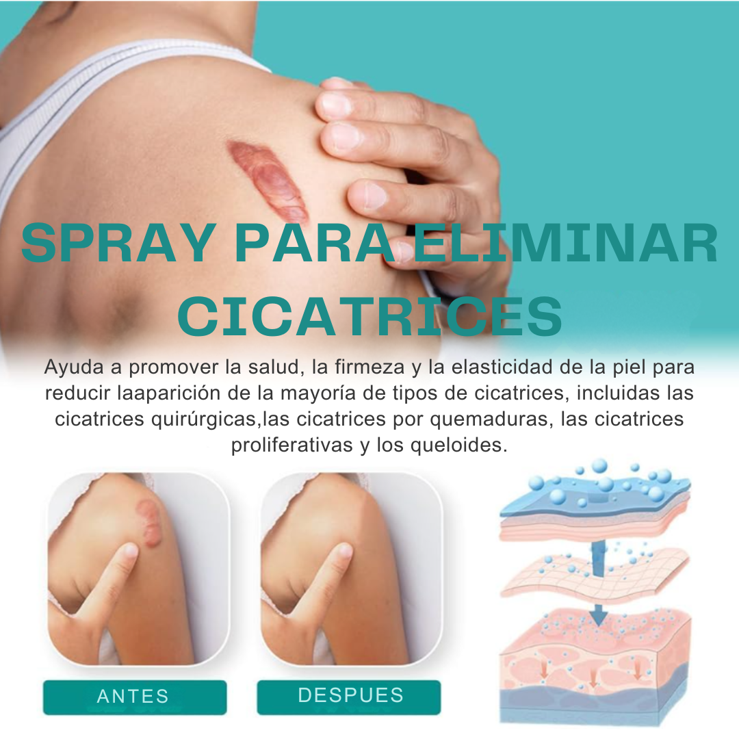 SouthMoon Spray™ Anticicatrices - La Cicatriz Cuenta Tu Historia, Pero Tú Decides Cómo Se Ve